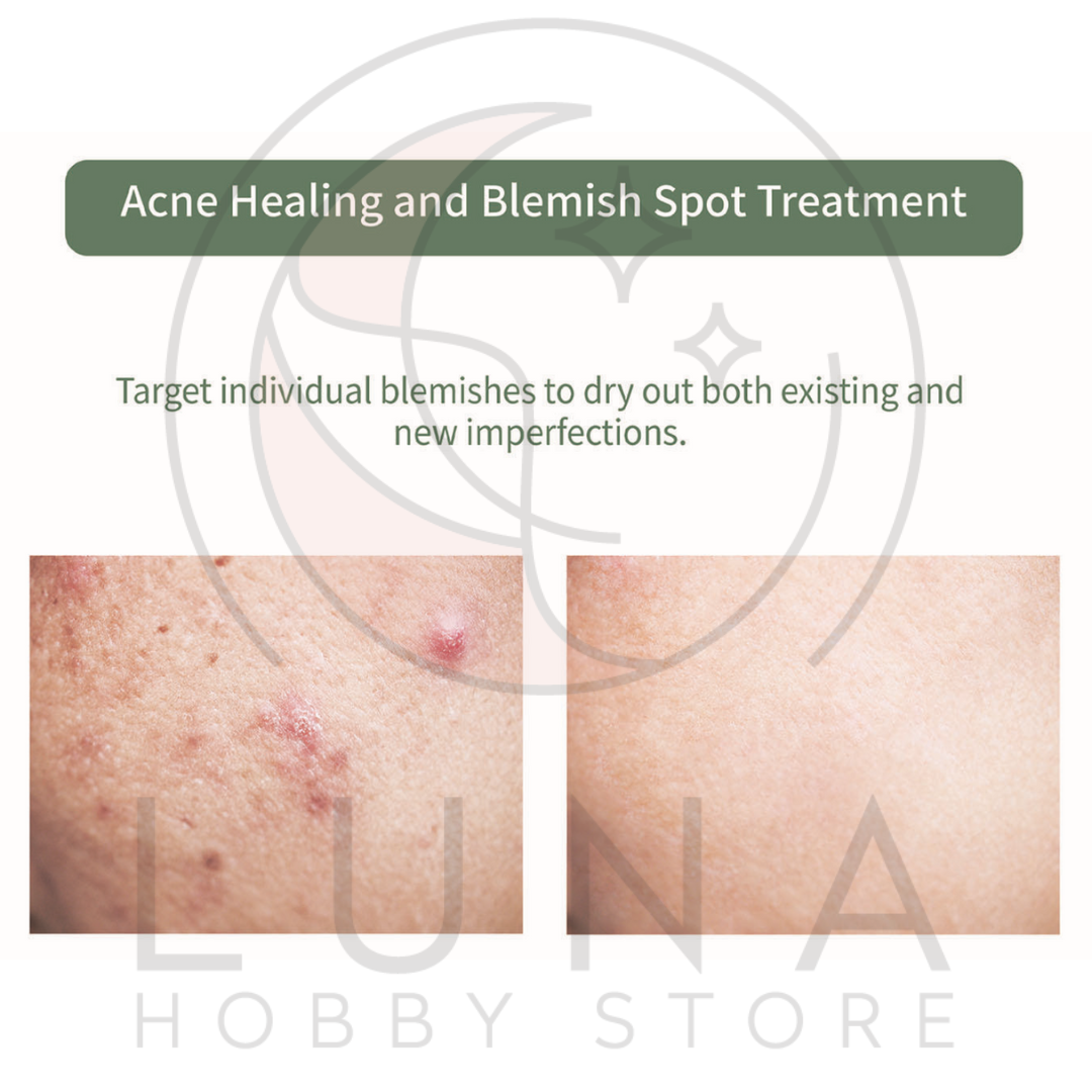 Veraclara | Tea Tree Blemish Spot Patches | 티트리 여드름 스팟 패치 (105 pcs) - Image 12